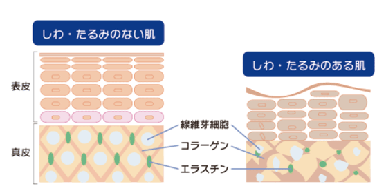 しわ・たるみのない肌としわ・たるみのある肌比較イメージ